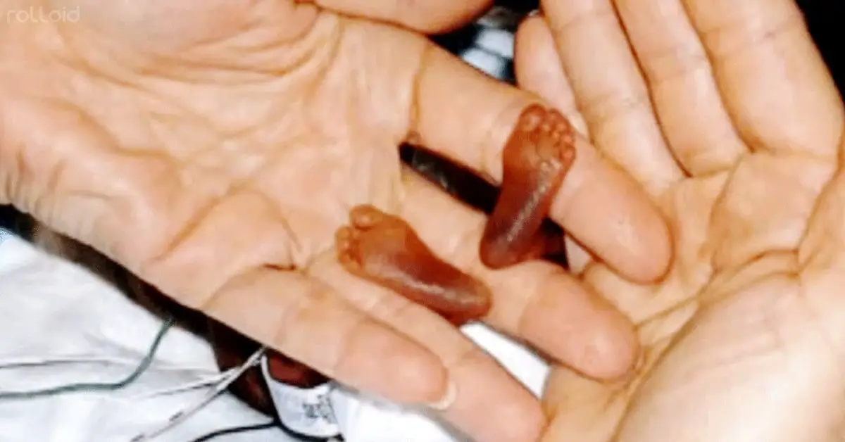 Ningún médico la habría traído al mundo si su madre no hubiese mentido