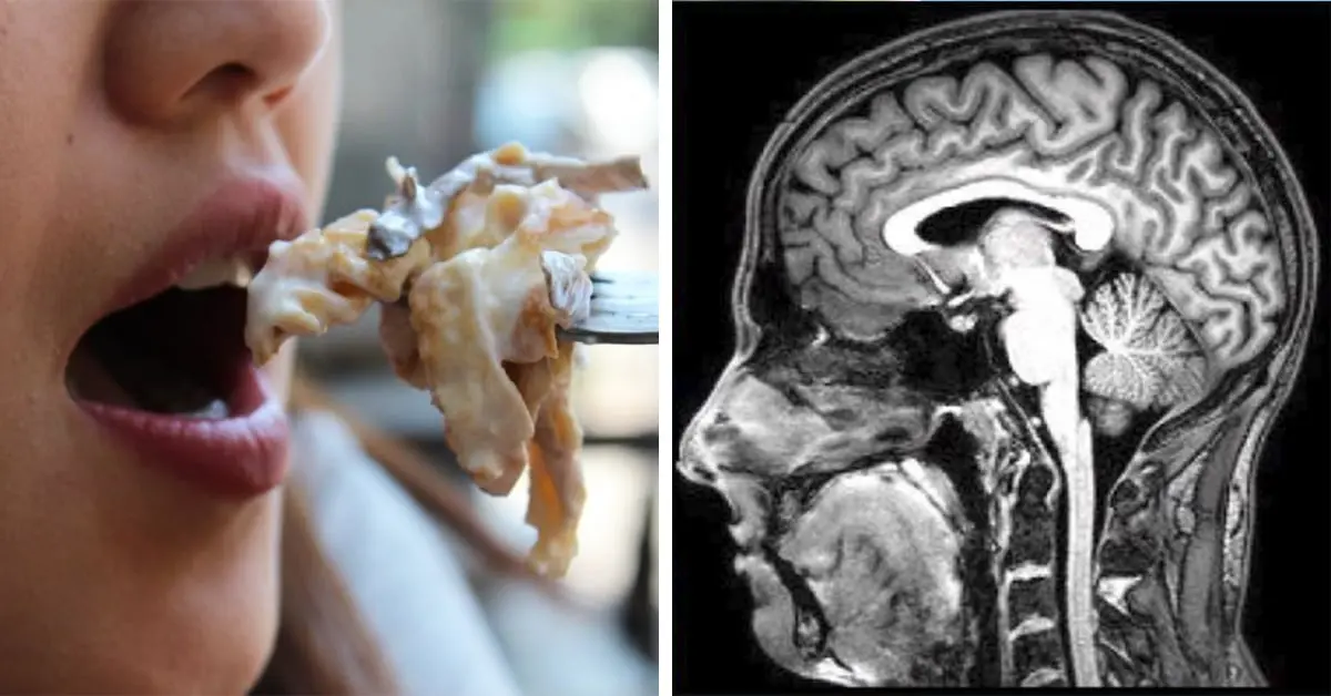Molestarse por el sonido al sorber la sopa o al masticar un chicle podría ser señal de un trastorno en el cerebro