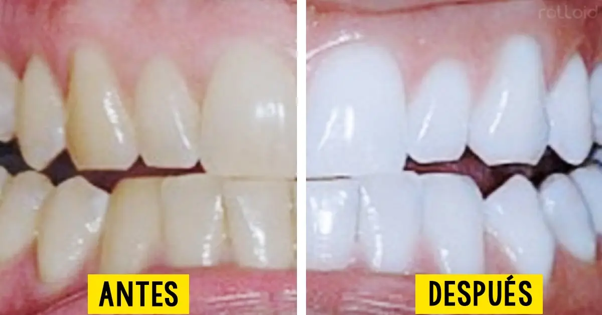 3 Cosas que puedes mezclar para conseguir unos dientes Blancos y eliminar las manchas