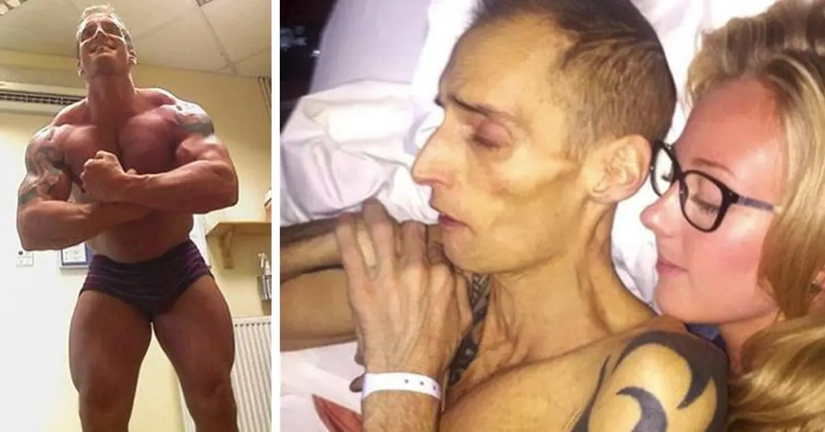 Dean Wharmby, la historia de un fisicoculturista que muestra los peligros de las bebidas que toman en el gimnasio