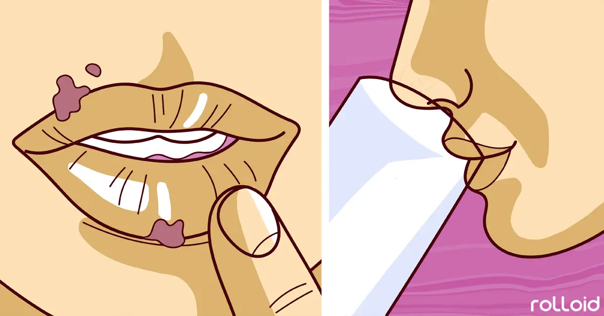 5 Errores que provocan la aparición del dichoso herpes labial y trucos para combatirlo