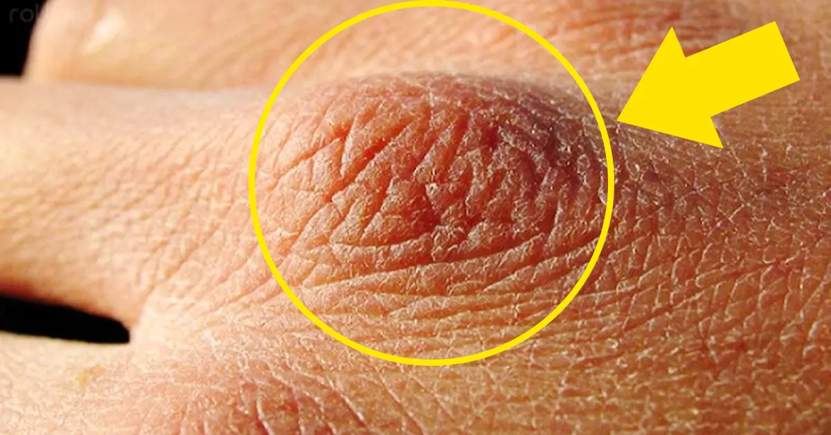 8 Importantes señales que tiene tu cuerpo de decirte que no bebes suficiente agua