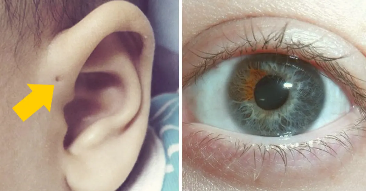 10 Mutaciones genéticas poco comunes que sólo algunas personas pueden tener