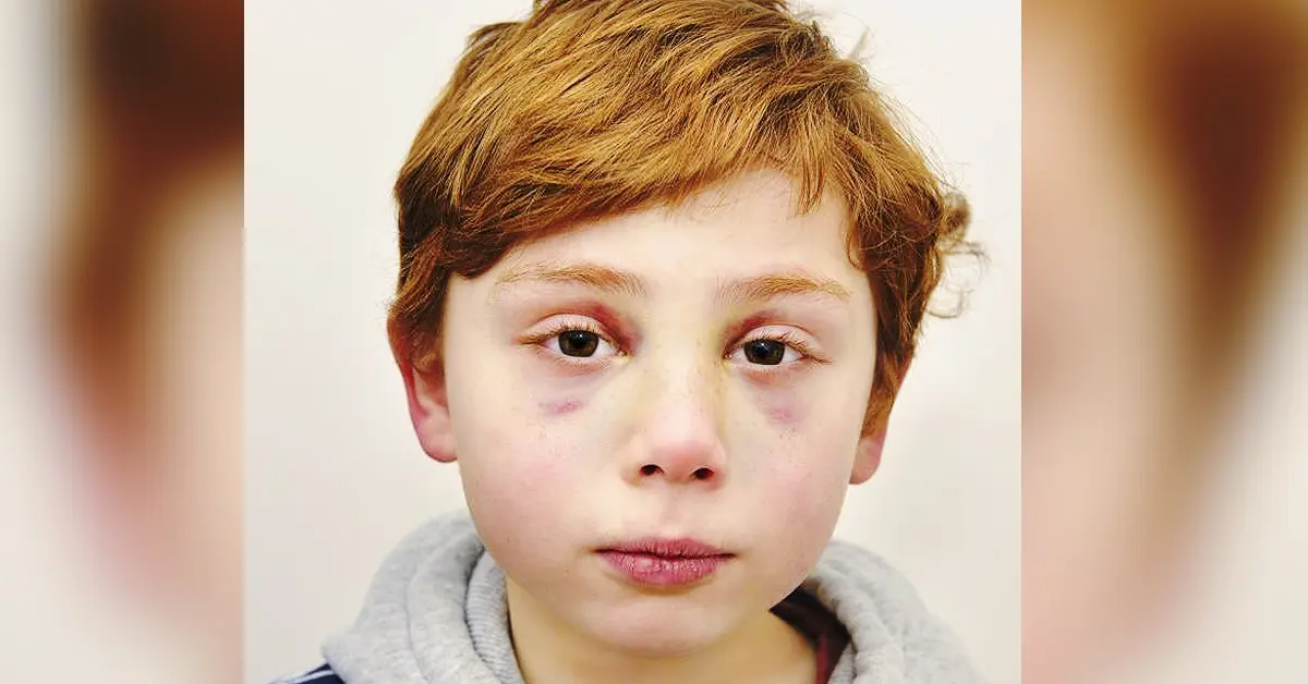 Un niño pierde la vida por culpa de sus padres y deja una emotiva carta al morir