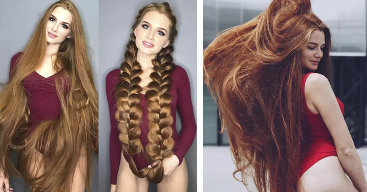8 Trucos que usó la chica de 18 años para luchar contra la alopecia y lucir la impactante melena que tiene ahora