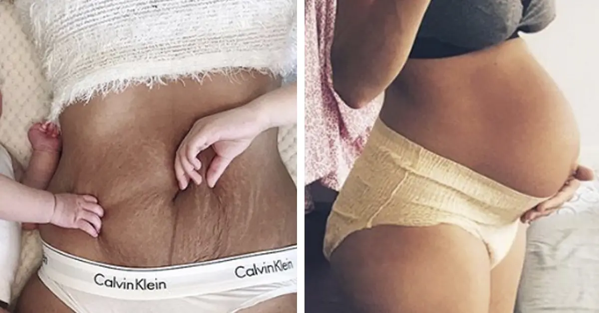 7 Imágenes que muestran la realidad del cuerpo de las mujeres días después de dar a luz