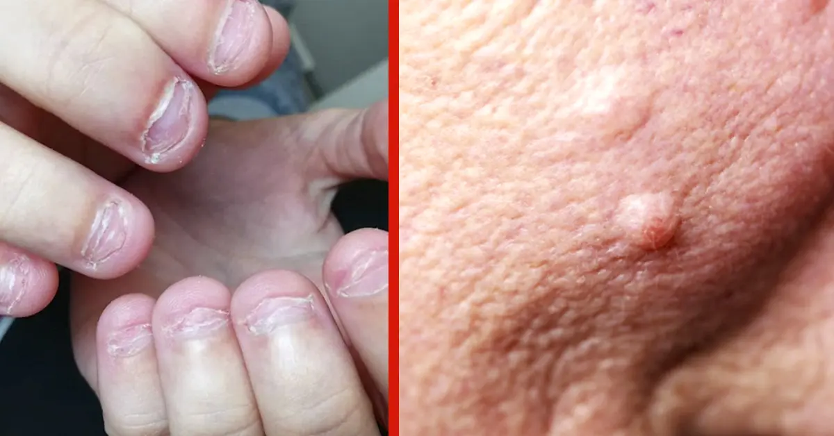 6 Razones por las que no deberías volver a morderte las uñas