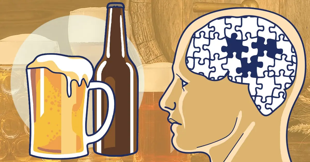 Un estudio muestra la fuerte conexión entre la cerveza y el Alzheimer