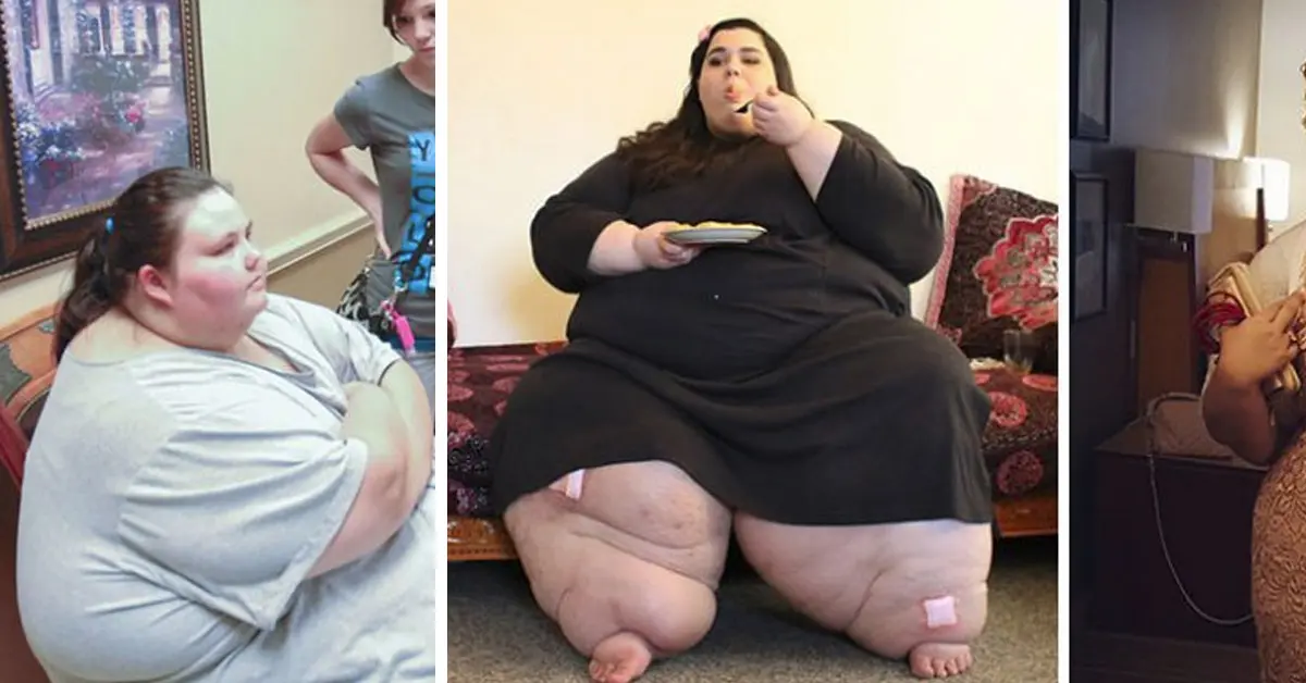 40 Imágenes del giro radical de personas que han perdido más de 200kg