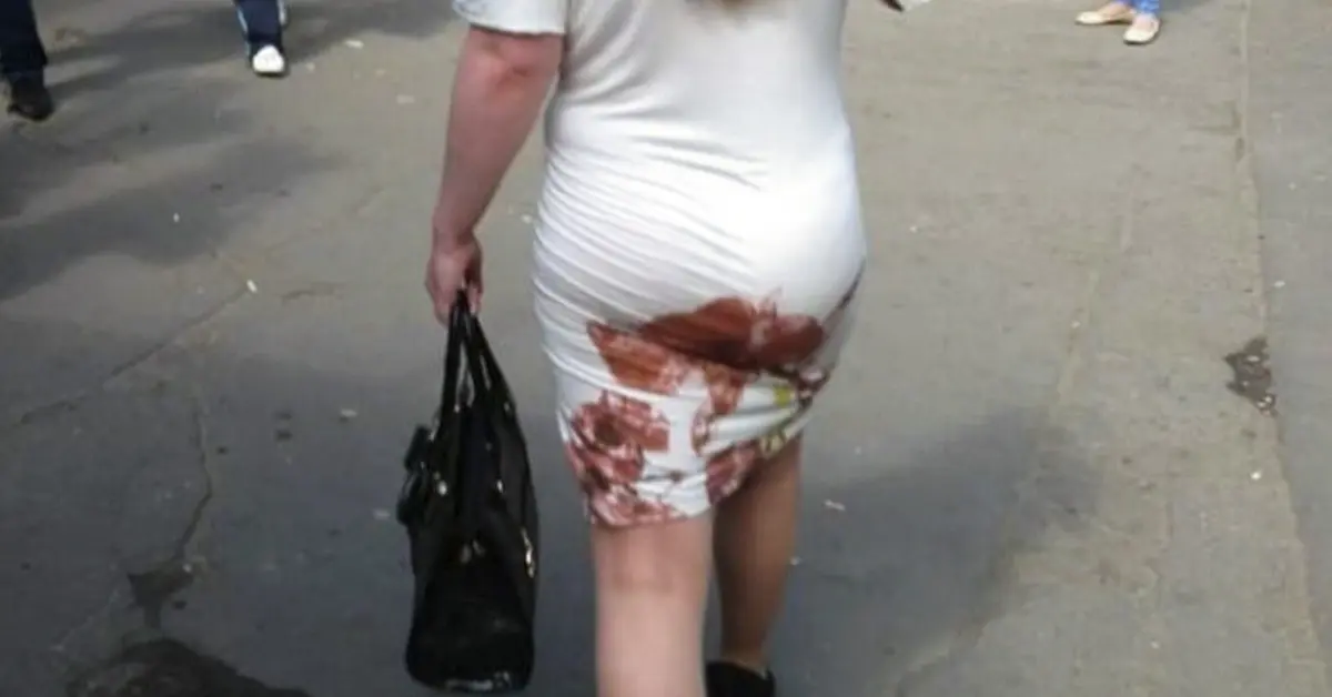 30 de los Diseños más desastrosos de la Historia que nadie se explica cómo los hicieron