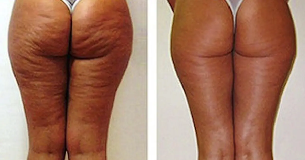 ¿Sabías todo lo que puedes hacer con granos de café que la mayoría desconoce?