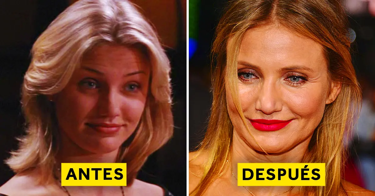 15 Famosas que dieron un giro radical al pasar por el quirófano