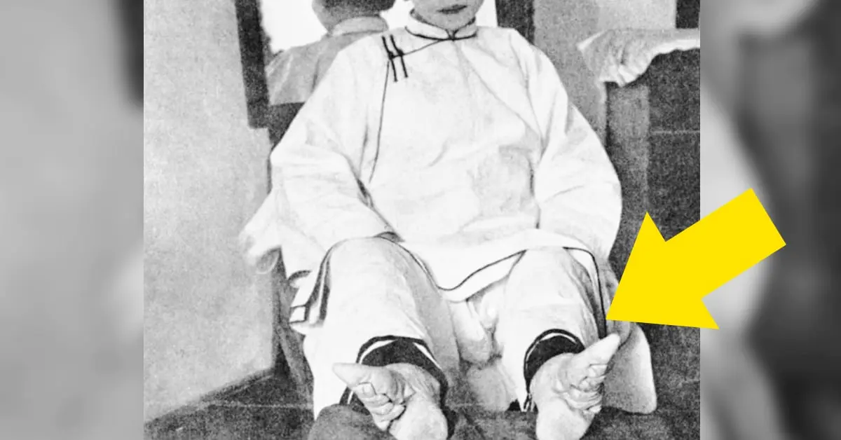 Las mayores locuras que cometían las mujeres en la antigüedad para verse mejor