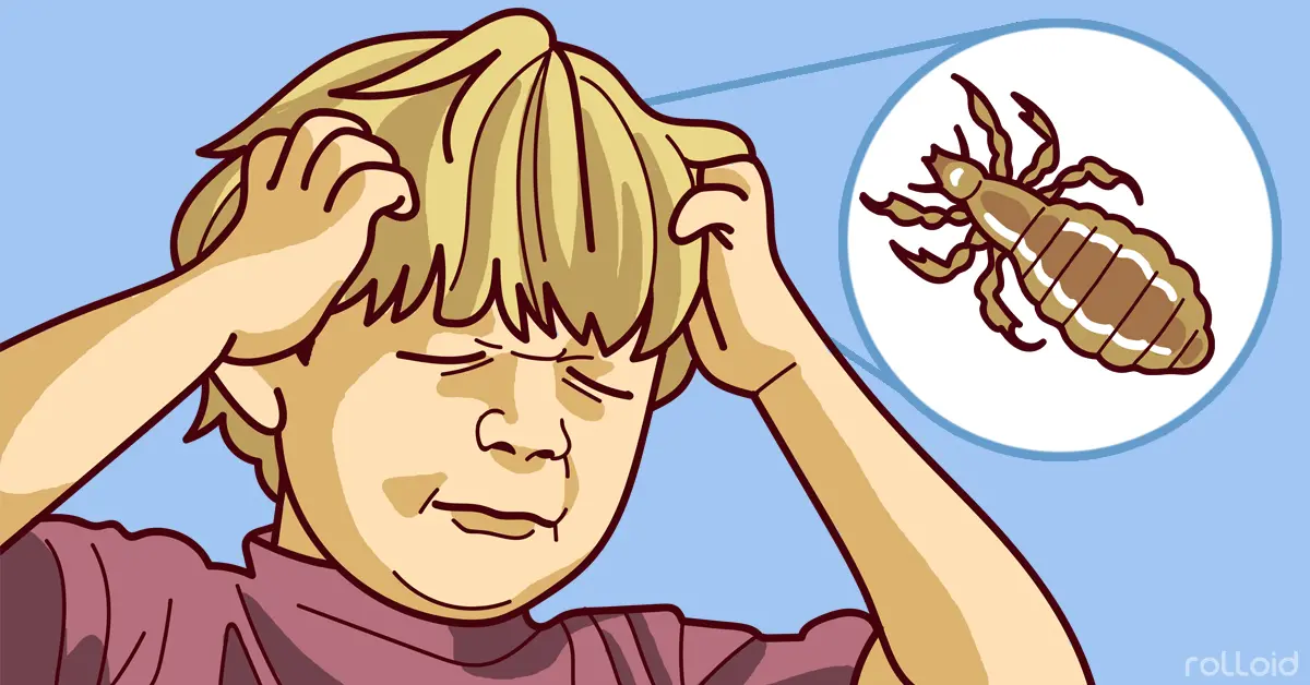 Te mostramos cómo eliminar los piojos de la forma más eficaz en un momento