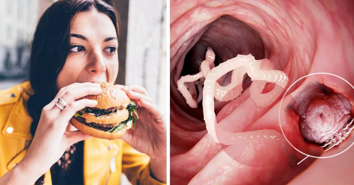 15 Cosas que le ocurren al cuerpo y que indican que podríamos tener parásitos dentro