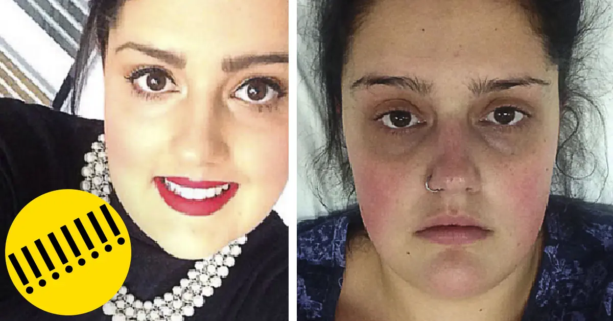 Una chica acaba ingresada en Cuidados Intensivos al descuidarse 'íntimamente'