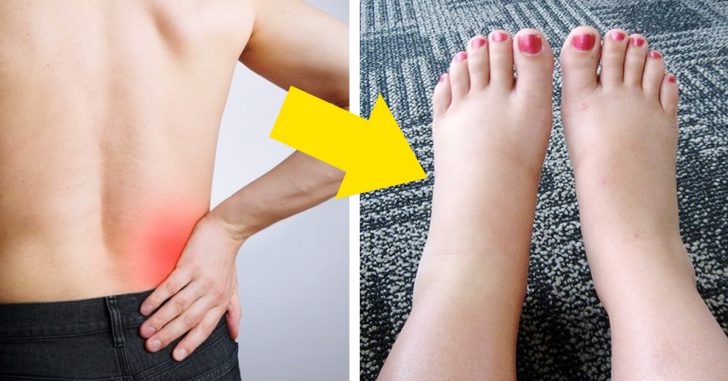 10 Signos que indican que puedes tener una enfermedad en los riñones