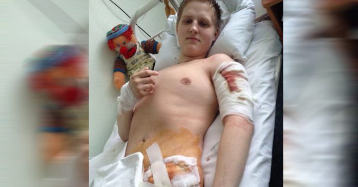 este joven amputado entrena duro para convertirse en atleta paralimpico y un modelo a seguir banner
