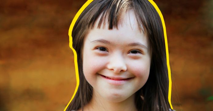 10 curiosidades que no conocias sobre el sindrome de down banner