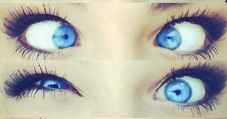 Porque Hay Turcos De Ojos Azules