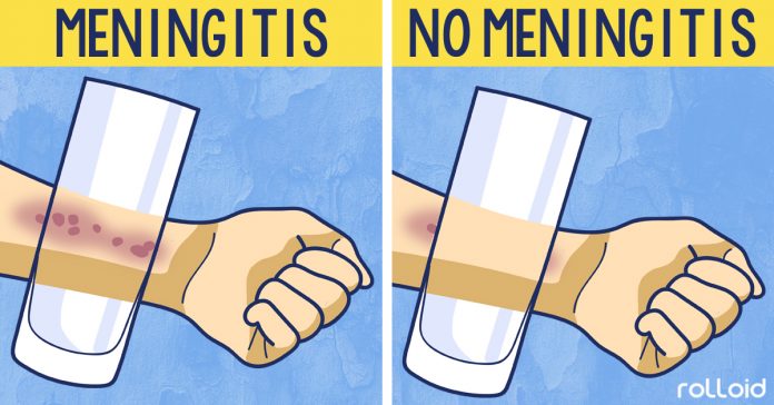 8 sintomas meningitis banner