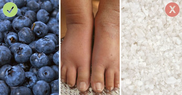 10 Trucos para reducir las inflamaciones e hinchazones con cosas de casa 2 prueba estos 10 alimentos para reducir la inflamacion banner